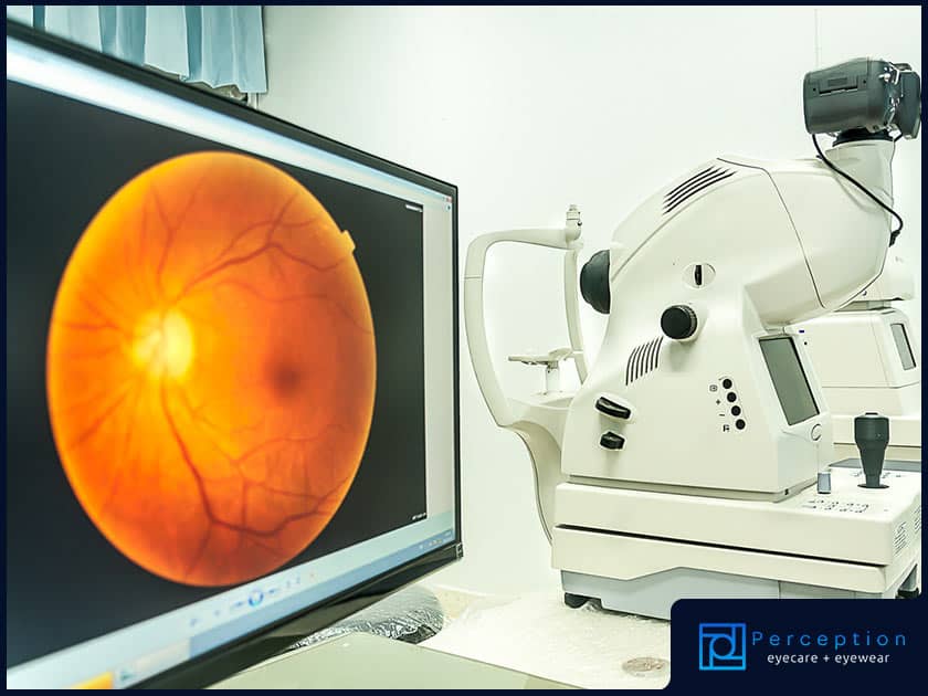 3 Eye Diseases That Retinal Imaging Can Detect