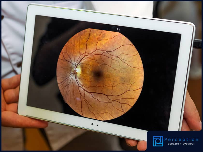 Essential Facts About Optos High-Resolution Retinal Imaging